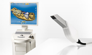 cerec_scanovani_ordinace